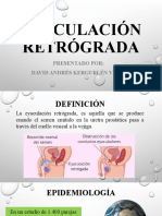 Eyaculación Retrógrada