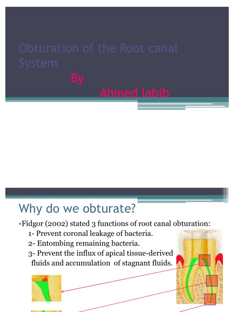 Monoblock Obturation Techniques in RCT | PDF | Materials | Manmade ...