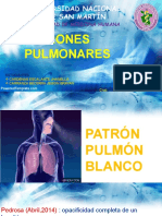 Patrones Pulmonares