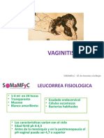 Vaginitis: causas y diagnóstico