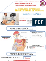 Anatomía, Semiología, Hiperplasia Prostática Benigna y Cáncer de Próstata