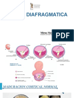 HOLOPROSENCEFALEA