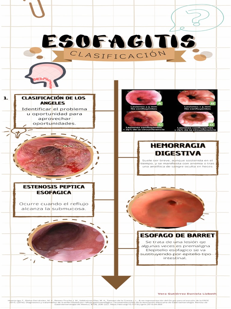 Esofagitis Alérgica Care Guide Information En Espanol – WVTC