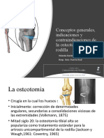 Osteotomia de Rodilla