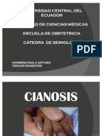 Semiologia Cianosis 2