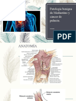 Patología Benigna de Mediastino y Cáncer de Pulmón