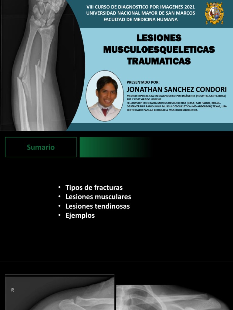 CLASE+5 +lesiones+musculoesqueléticas+traumáticas | PDF