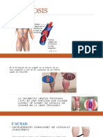 TROMBOSIS