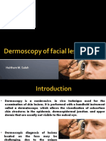 Dermoscopy of Facial Lesions