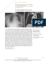 MAR 2 Isolated Persistent Left Superior Vena Cava