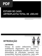 ESTUDO de CASO Artroplastia de Joelho