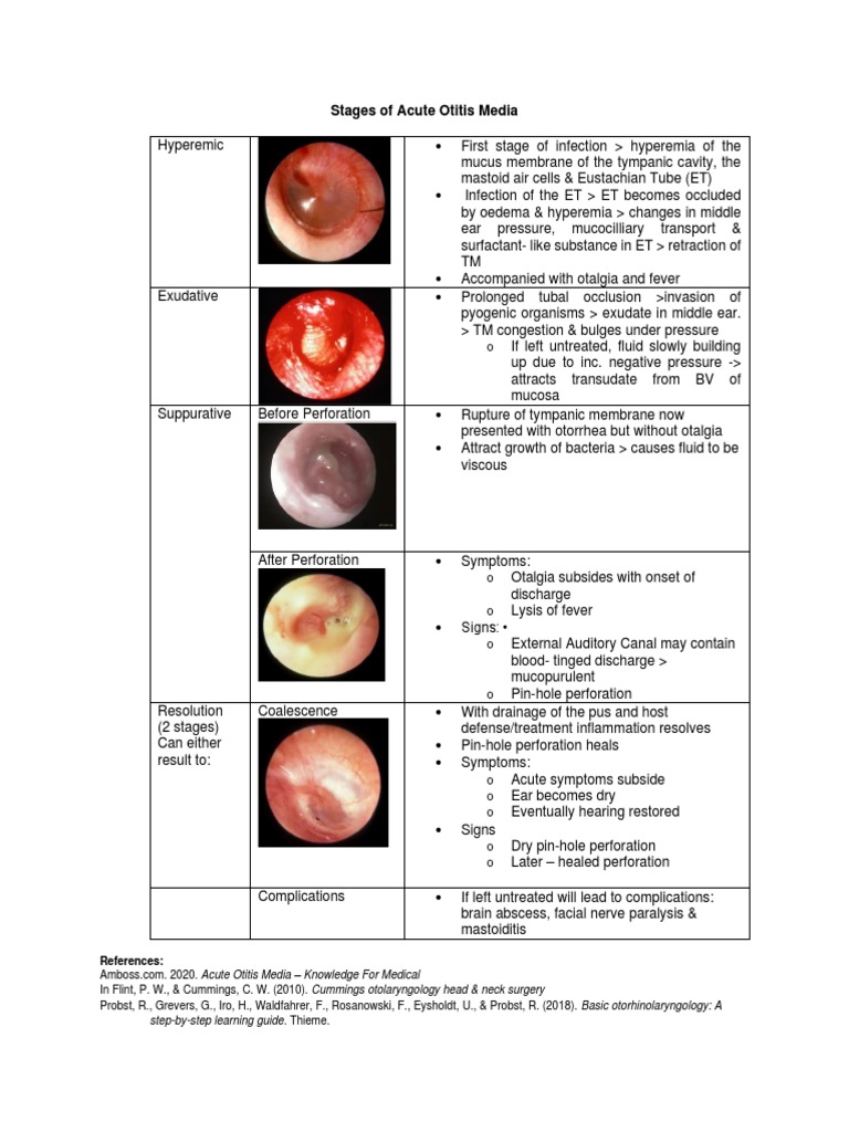 Stages Of Acute Otitis Media Pdf Surgical Specialties Health Sciences
