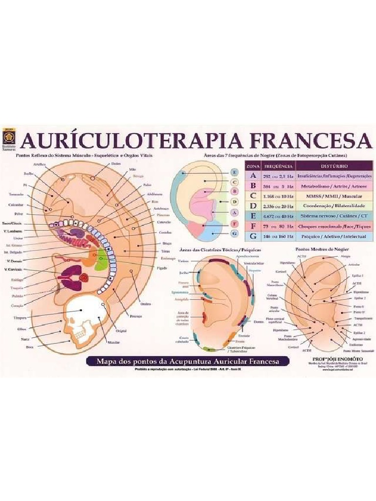 Mapa Auriculoterapia Francesa D - NQ - NP - 956341 mlb27932788254 ...