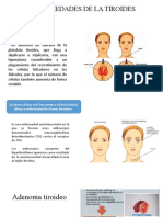 Enfermedades de La Tiroides