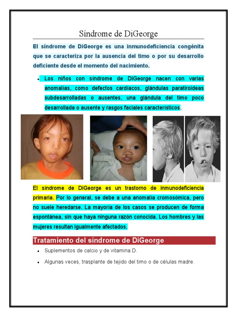 Síndrome de DiGeorge: Características y Tratamiento | PDF