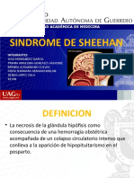 Sindrome de Sheehan Endocrino