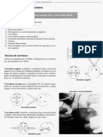 Trans Fontanel A