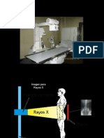 Densidades en radiografía y tomografía