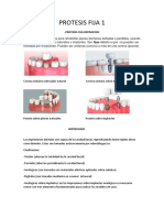 1-Protesis Fija 1