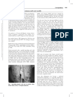 A Case of Dolutegravir Induced Cutaneous Small.18