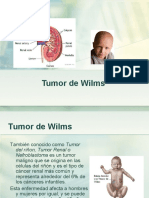 3711750-Tumor-de-Wilms