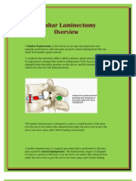 Lumbar Laminectomy Spine Surgery in India at Delhi & Mumbai at Affordable Cost