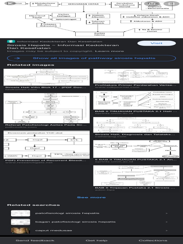 Pathway Sirosis Hepatis - Google Search | PDF | Kesehatan Holistik