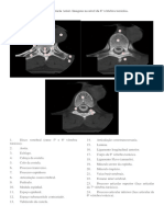 Roteiro TC Coluna Vertebral Torácica Axial