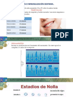 Erupcion Dental