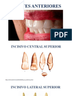 Dientes Anteriores Determinantes