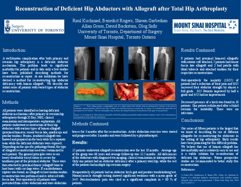 Hip Abductor Reconstruction Using Allograft PDF Hip Surgery