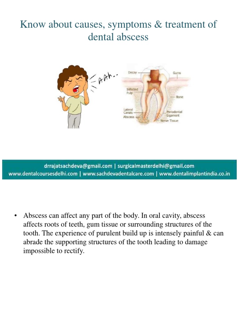 Dental Abscess PDF Periodontology Medicine