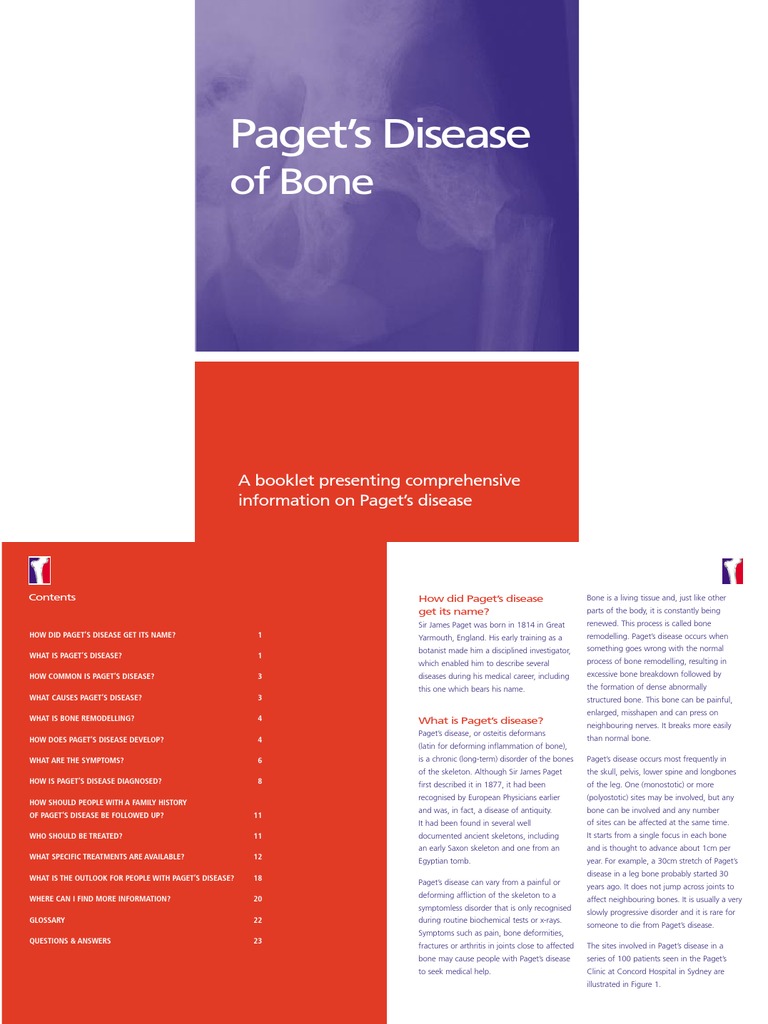 An InDepth Look at Paget's Disease of Bone Causes, Symptoms