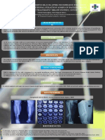 Peripheral Nerve Block (PNB)