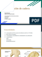 Luxación de cadera: Generalidades, clasificación, diagnóstico y tratamiento