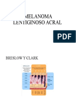 Melanoma Lentiginoso Acral