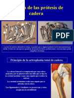 1 - Historia de Las Protesis Totales de Cadera