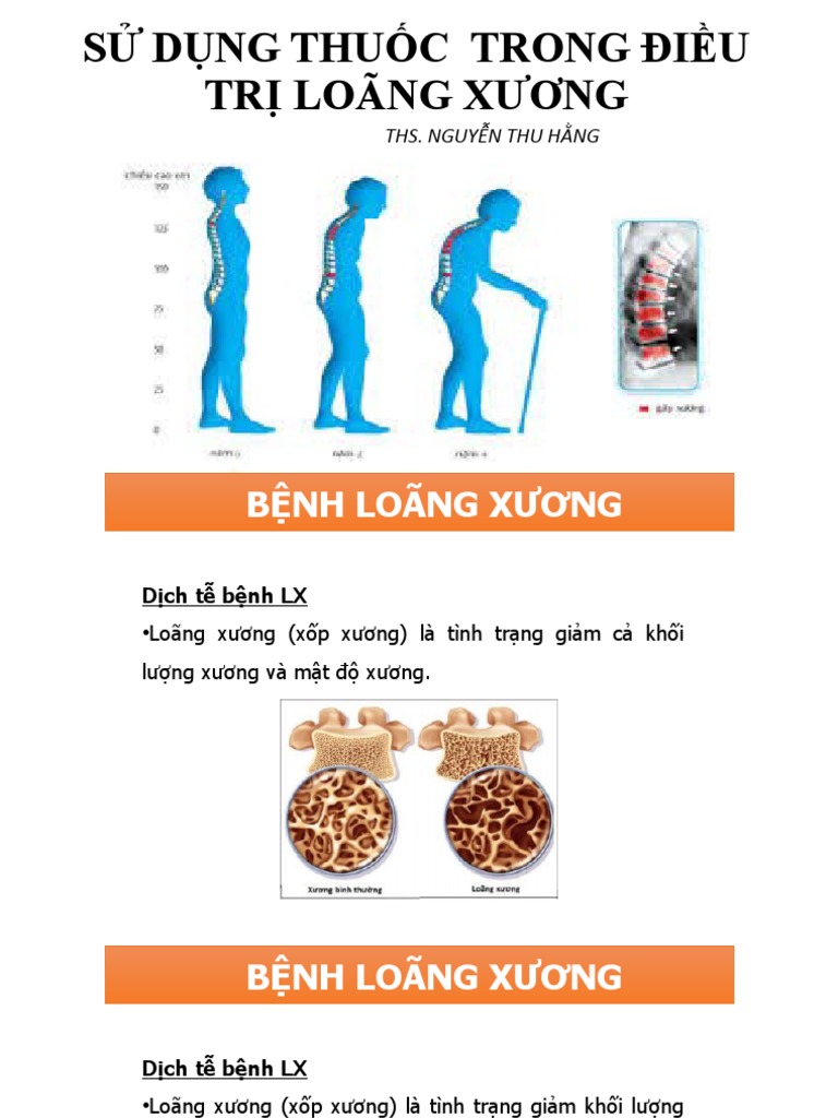 Loãng Xương | PDF