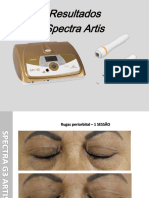 Resultados - Corporal e Facial - Equipamento - Spectra Artis-1590424524