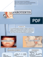 PAROTIDITIS