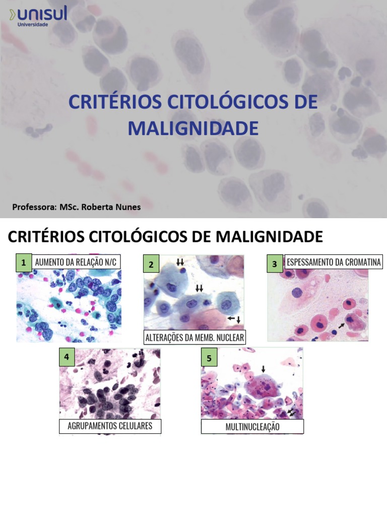 Critérios Citológicos de Malignidade | PDF | Câncer cervical | Anatomia