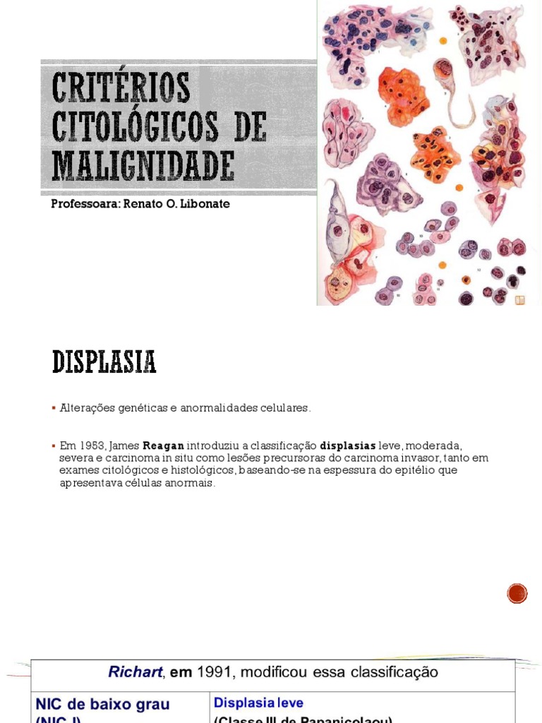 Aula 9 de Critério de Malignidade | PDF | Núcleo celular | Célula ...