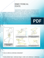 Cateterismo Vesical Intermitente