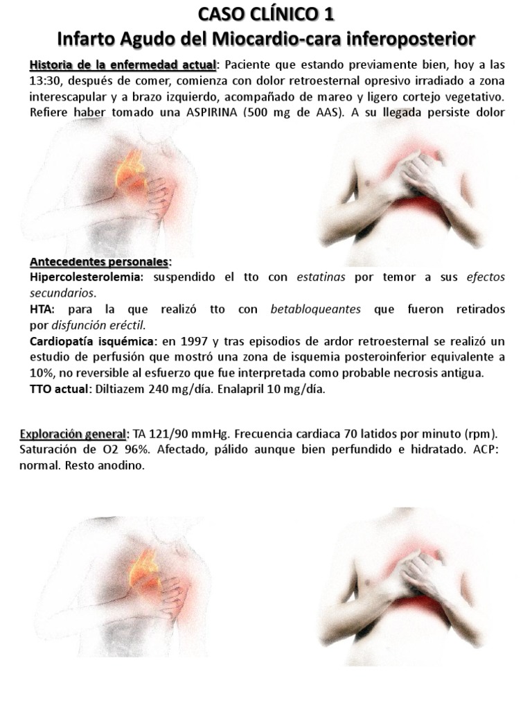 Caso clínico: Cardiopatía isquémica | PDF | Infarto de miocardio ...
