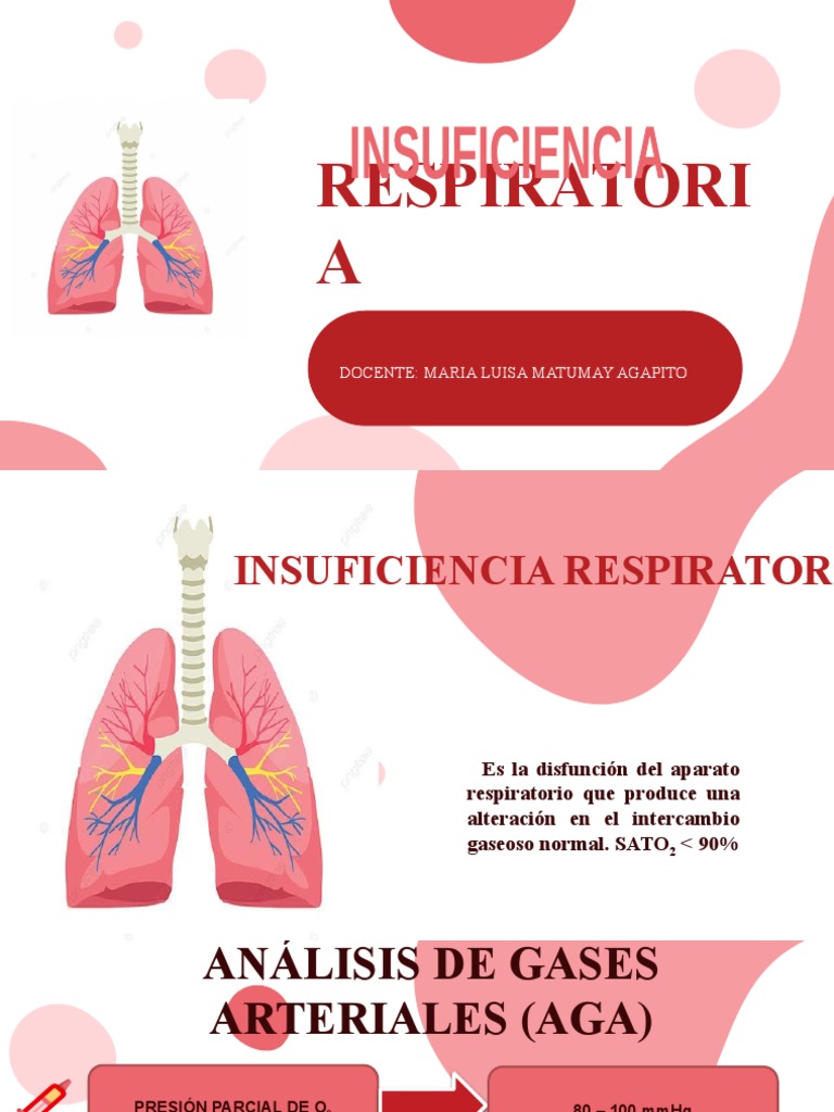 Insuficiencia Respiratoria PDF Neumonía Tos