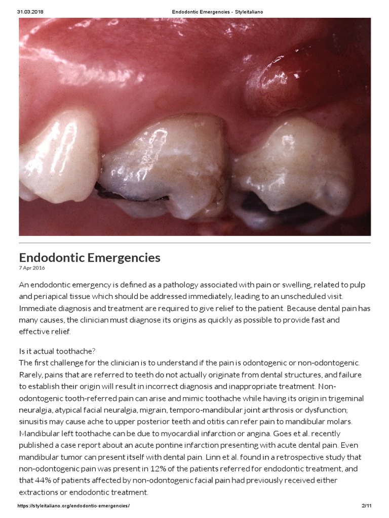 Endodontic Emergencies Styleitaliano PDF