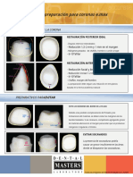 Preparation Guidelines For E.max Crowns - En.es