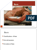 Types Classifications Prevention First Aid Burns