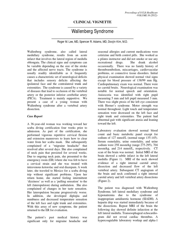 Wallenberg Syndrome | PDF | Nervous System | Causes Of Death