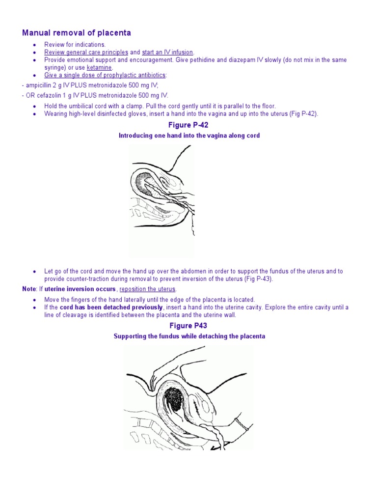 Manual Removal of Placenta PDF